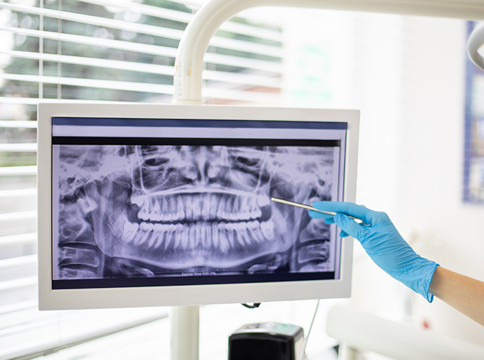 Digital X-Rays Image