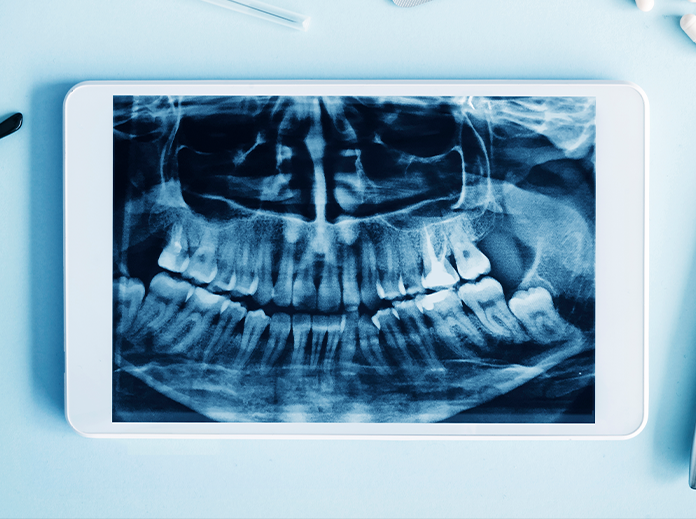 Panoramic X-Ray Image