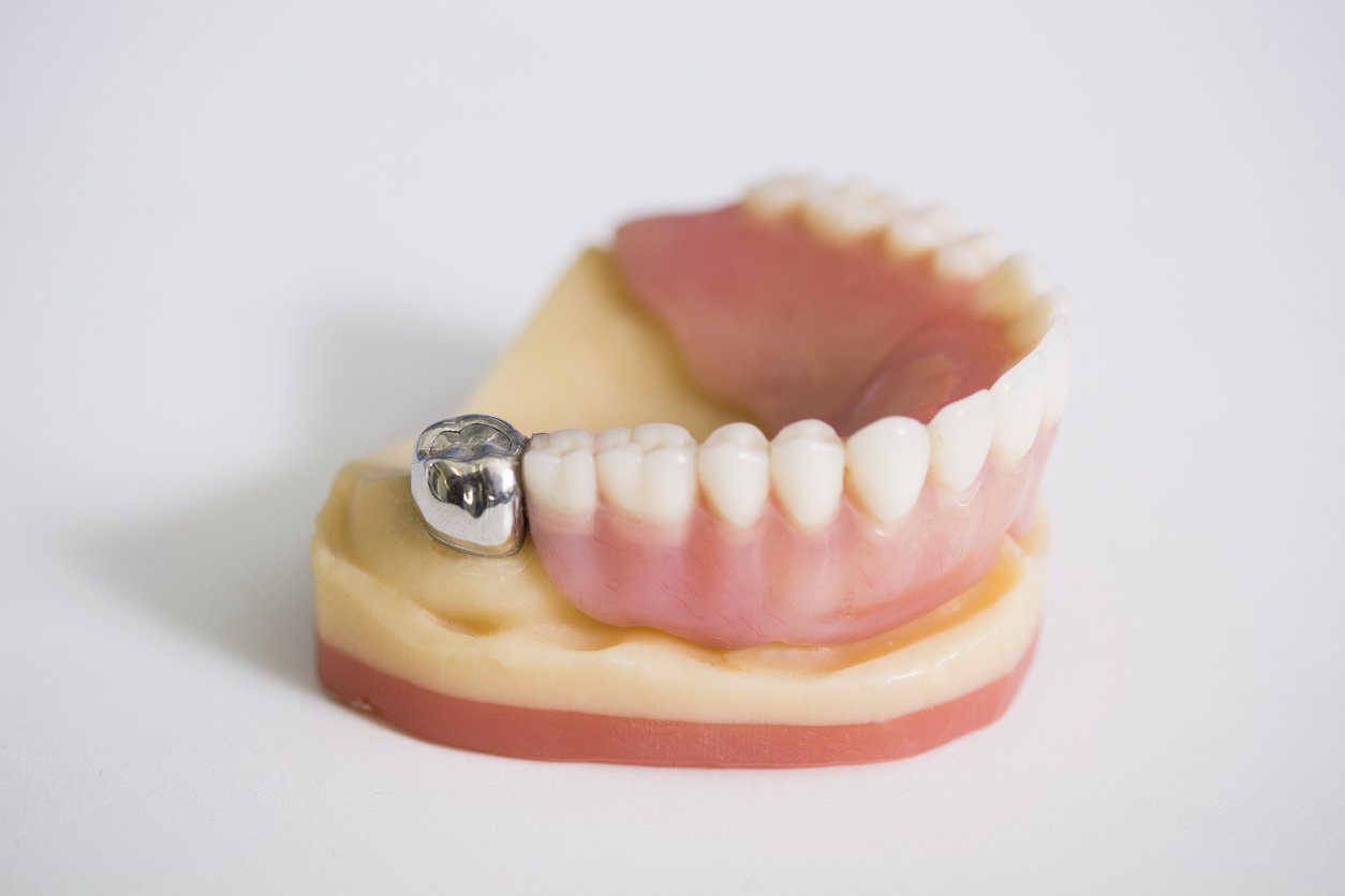 Stainless Steel Crown Image